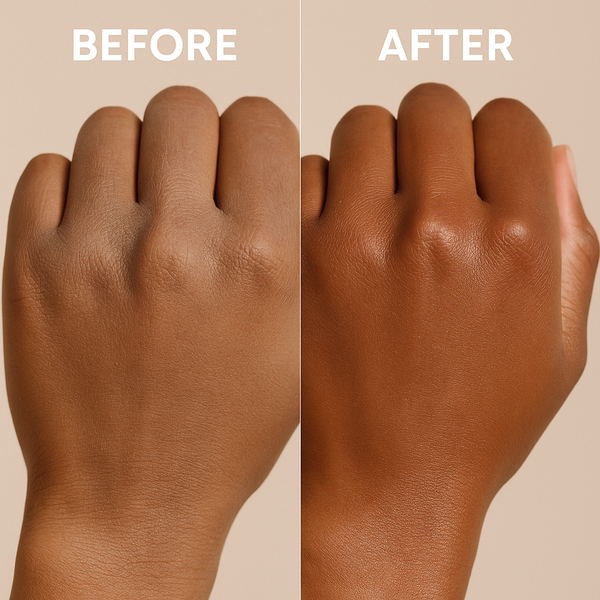 Blog Post: Before & After – Coco Skin Transformations