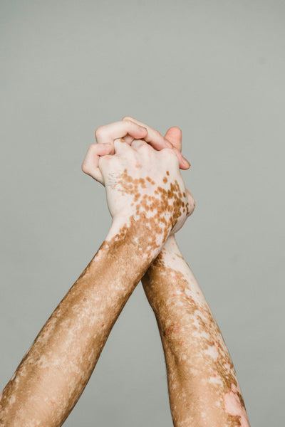 How to Spot High-Quality Skincare Products for Dry Skin